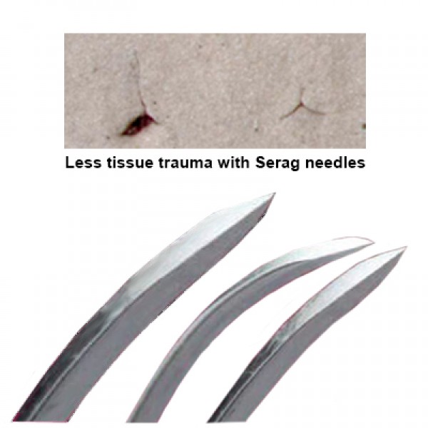 spring_eye_surg_need